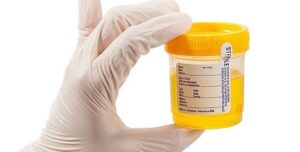 synthetic urine samples